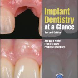 Implant Dentistry at a Glance / Edition 2 - Jacques Malet