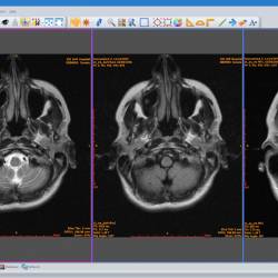 Sante DICOM Viewer Pro 14.3