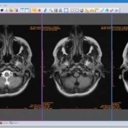 Sante DICOM Viewer Pro 14.3