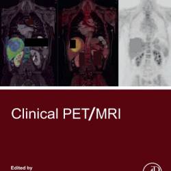 Clinical PET/MRI - Onofrio Antonio Catalano (Editor)