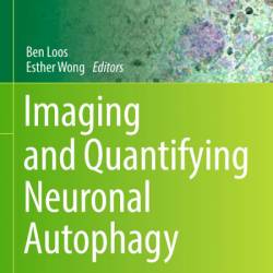 Imaging and Quantifying Neuronal Autophagy - Ben Loos (Editor)
