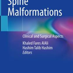 Congenital Spine Malformations: Clinical and Surgical Aspects - Khaled Fares AlAli