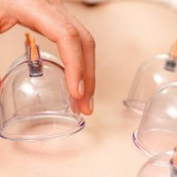 Udemy - Certified Course - Practical Cupping Therapy