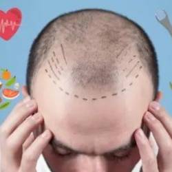 The Complete Hair Loss Solution