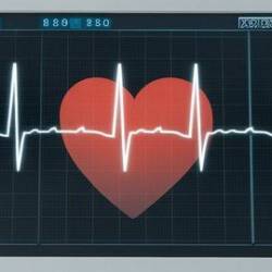 Ecg - Draw 12 Leads In 5 Minutes