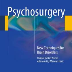 Psychosurgery: New Techniques for Brain Disorders - Marc L&#233;v&#234;que