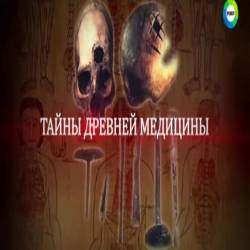 Тайны древней медицины (2015) SATRip