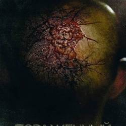  / Afflicted (2013) HDRip